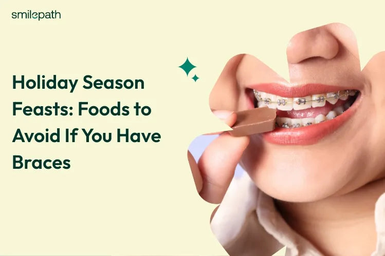 Holiday Season Feasts: Foods to Avoid If You Have Braces
