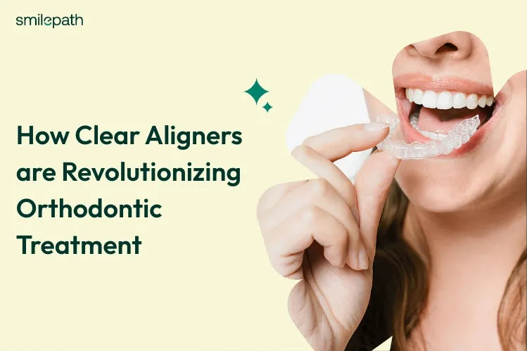 How Clear Aligners are Revolutionizing Orthodontic Treatment