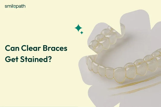 Stained clear aligners on a white background