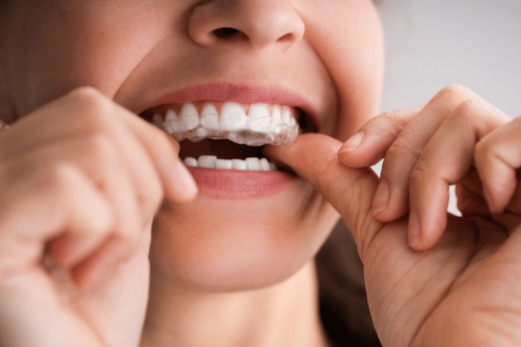 Dental Guard
