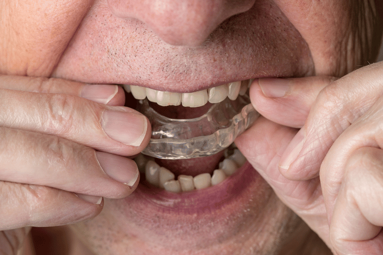 Aging Gracefully: Solutions for Shifting Teeth in Older Adults