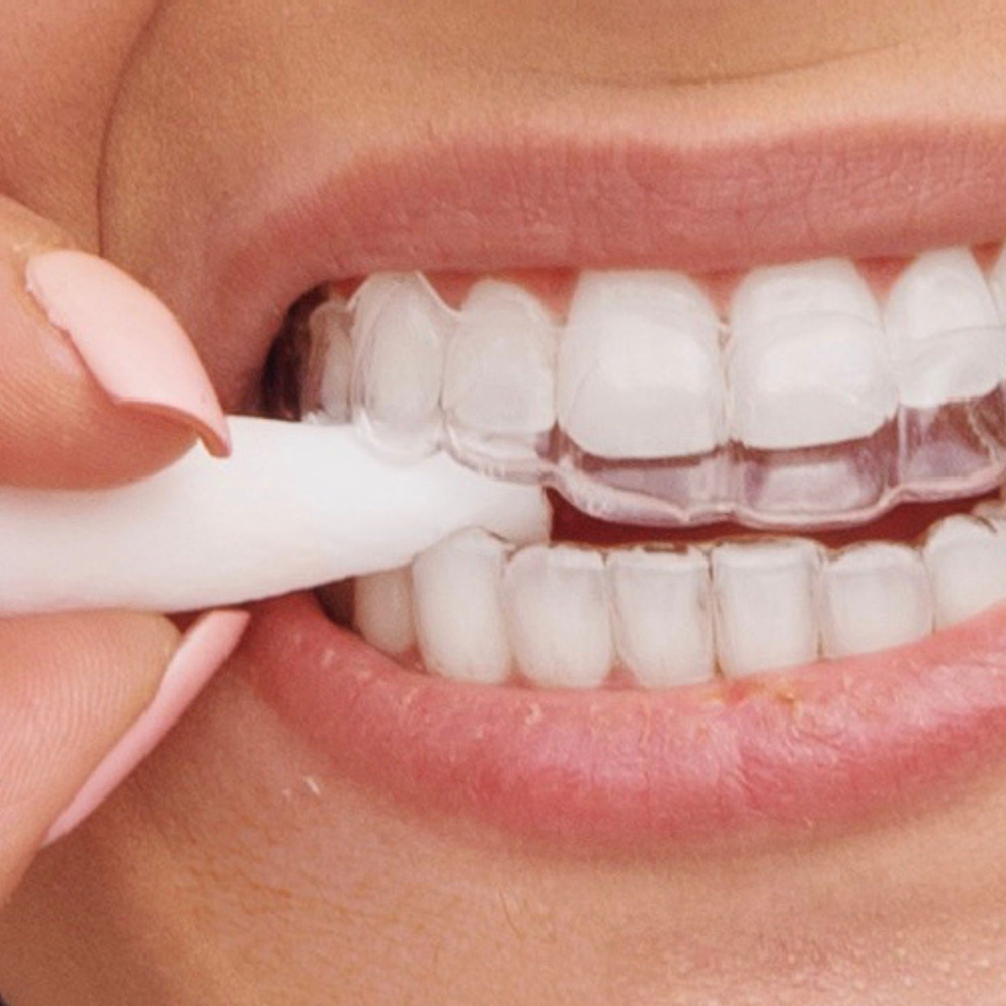 SMILEPATH Chewies