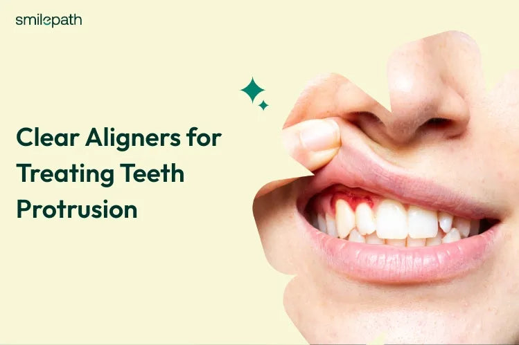 A close-up of a woman with protuded upper teeth 