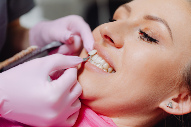 A dentist applying a veneer to a tooth of a patient