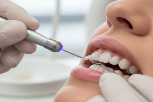 A dentist bonding a chipped and cracked tooth