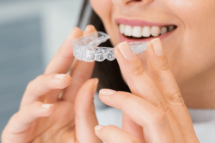 clear aligners