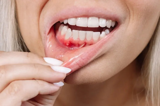 A girl suffering from periodontitis