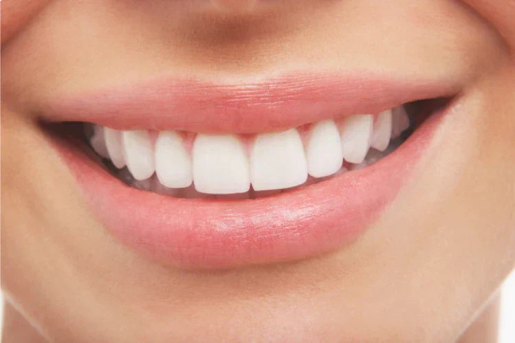 A woman showing her perfect teeth alignment 