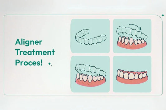 A collage of different steps of aligners treatment process turning misaligned crooked teeth to perfectly straight teeth
