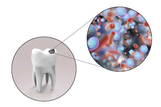 An illustration of a tooth with a cavity and a detailed close‑up view of bacteria 