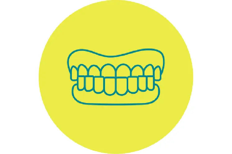 An illustration of underbite