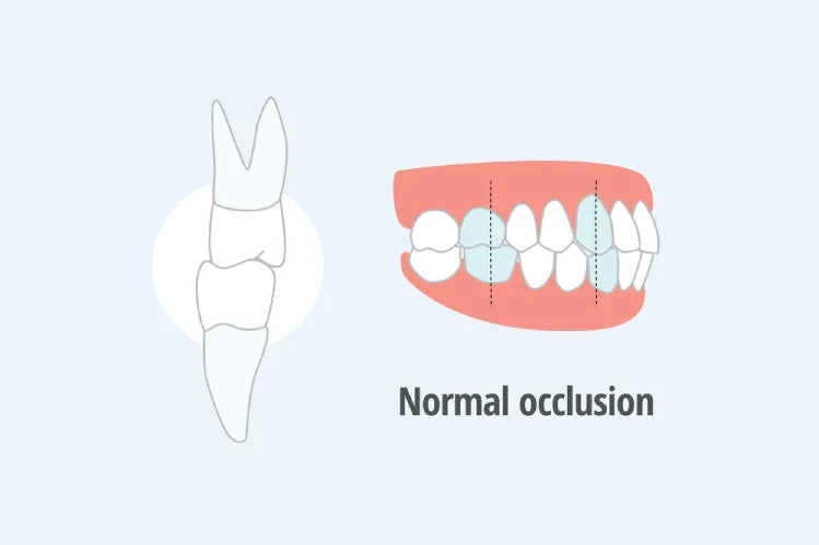 An illustration of what a normal occlusion looks like