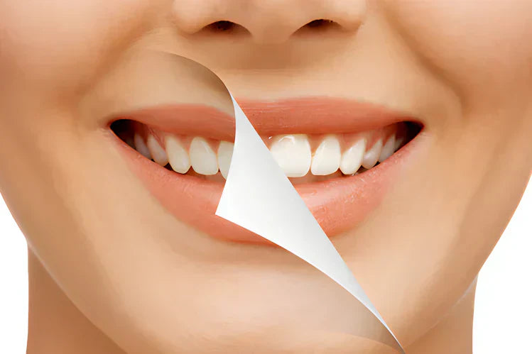 An image of a girl showing before and after of a smile makeover