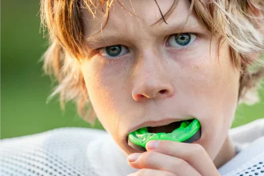 Thumbnail for 5 Simple Steps to Keep Your Mouth Guard Clean and Hygienic