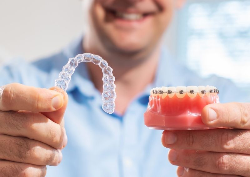 Clear-Braces-Cost-Are-They-Cheaper-Than-Metal-Braces?