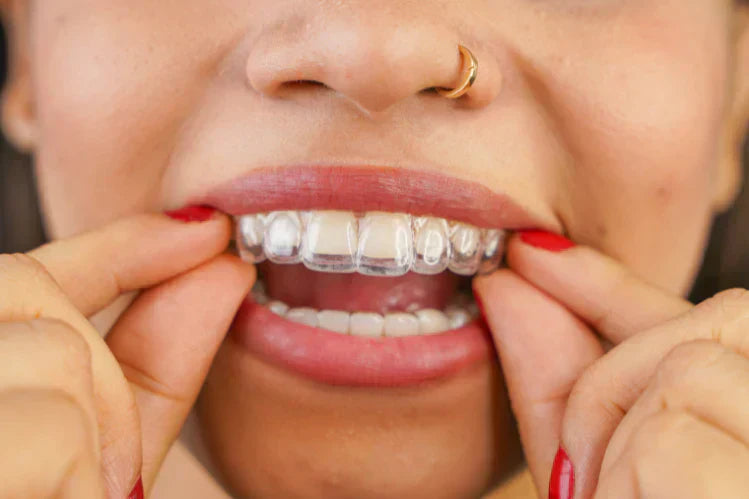 A girl is wearing clear aligners