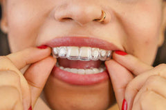 Are Aligners a Good Alternative?