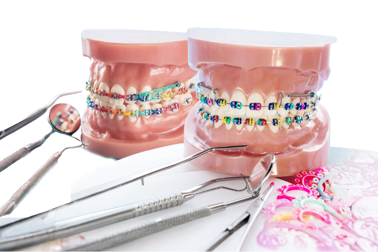 Dental models with color braces