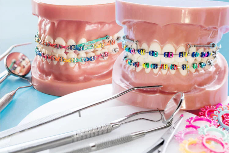 An image of colorful braces of teeth models