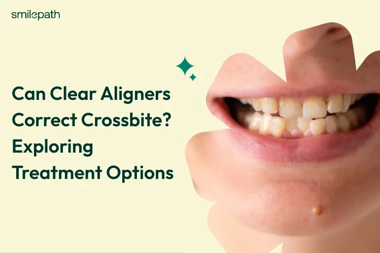 A person with crossbite in his posterior teeth