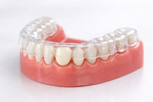  A dental model of the lower arch with a single tooth crown and a transparent night guard.