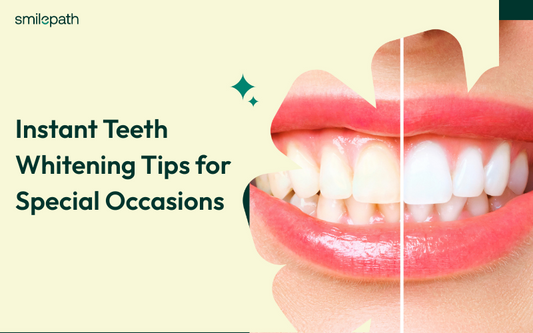 Before and after images of whitened teeth.
