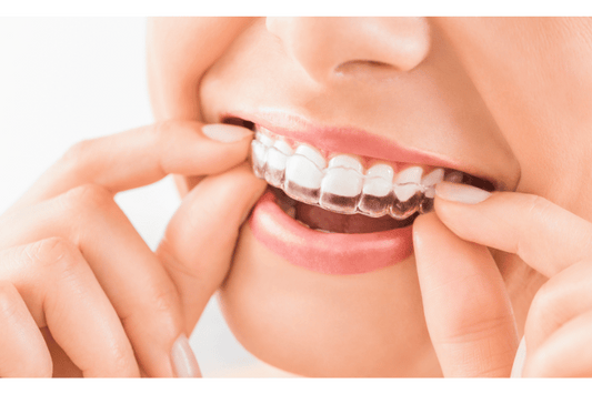 Orthodontic treatment