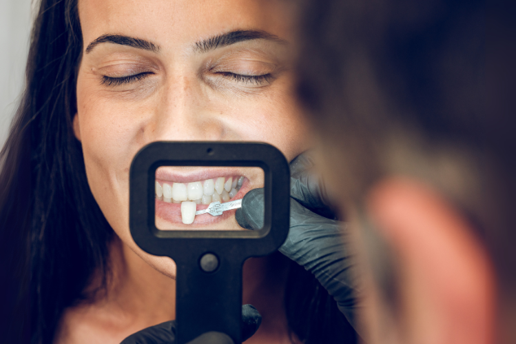 Dentist picking a sample of teeth veneer for a woman