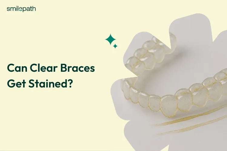 Stained clear aligners on a white background