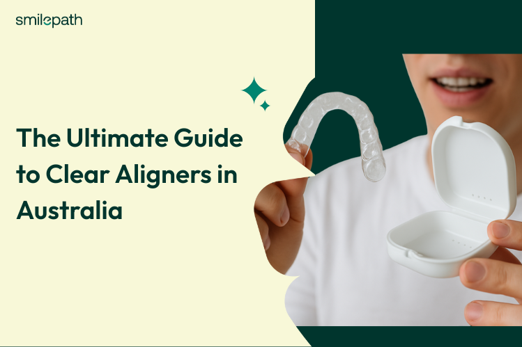 The Ultimate Guide to Clear Aligners in Australia