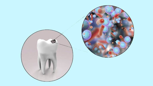 Things-You-Don’t-Know-About-Cavities