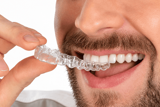 How Long Does Clear Aligner Treatment Take?