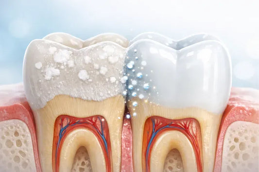 An image shows a healthy vs damaged enamel comparison
