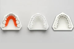 What Are Retainers and Why Are They Important?