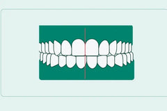 Can Clear Aligners Fix Midline Misalignment