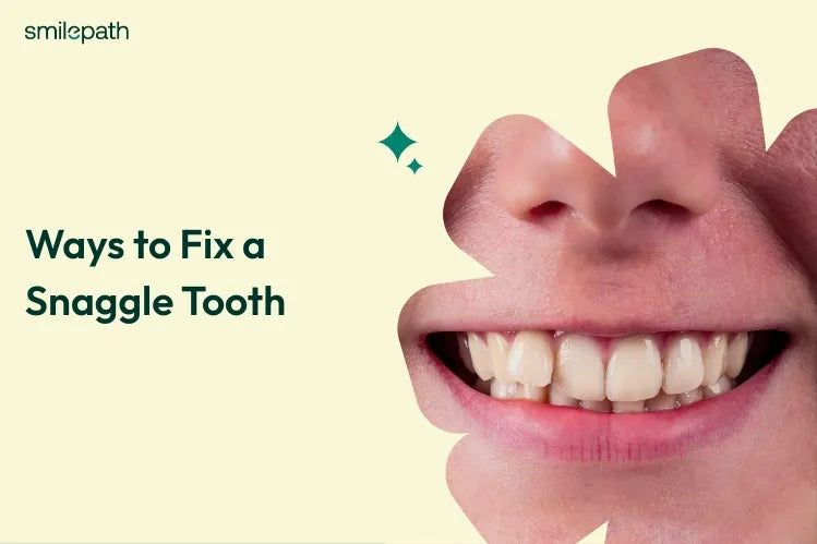 Close-up of a young woman’s smile showing snaggle tooth on a white background