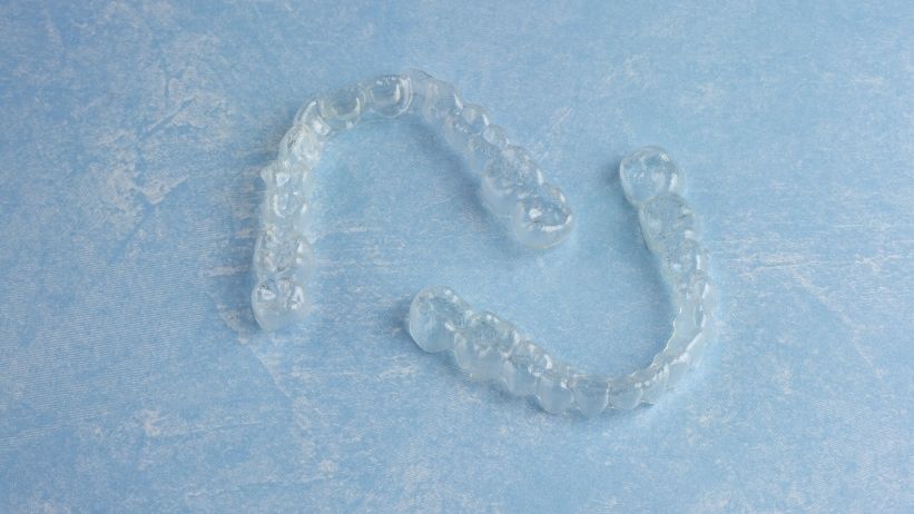 What-You-Need-To-Know-Before-Getting-Clear-Aligners