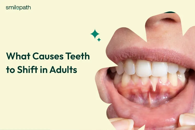 A girl showing her receding gums, one of the reasons for teeth shifting