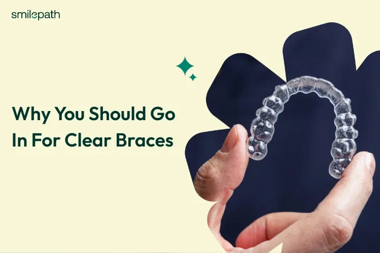 A man holding a clear aligner in his hand