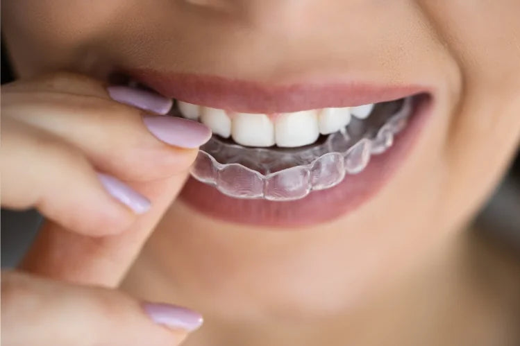 Invisible_Aligners