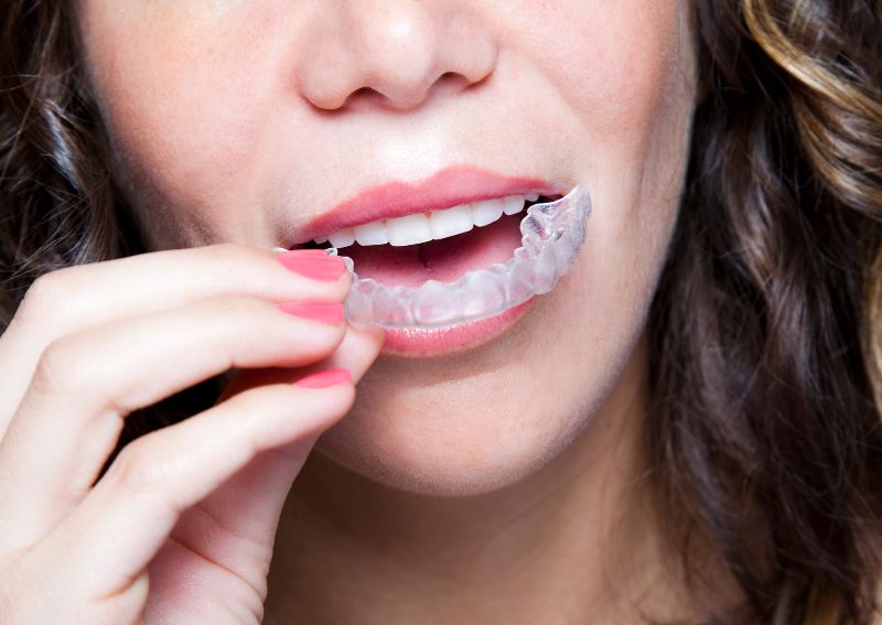 Oral Hygiene
