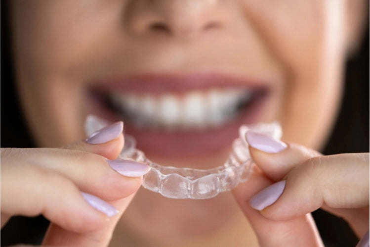 Removable clear aligners