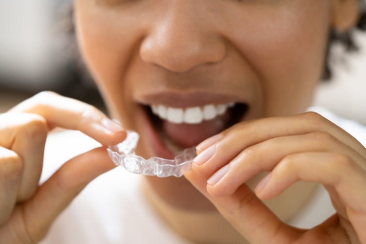  clear aligners.