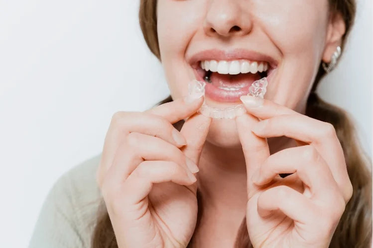 clear aligners to fix overbite