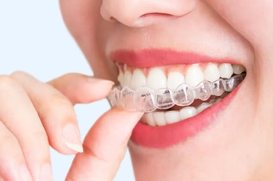A girl wearing clear aligners for dental arch expansion