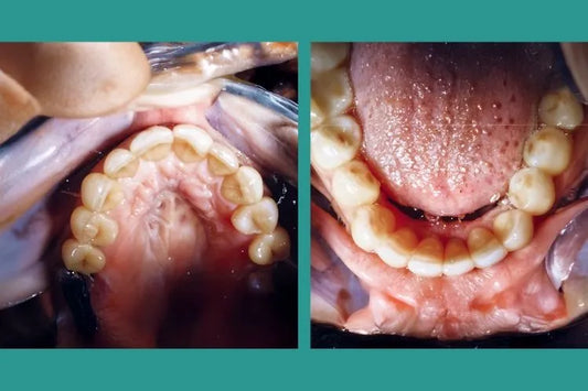 Close up of rotated teeth