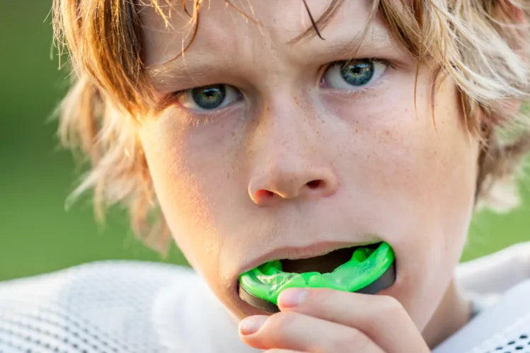 Thumbnail for Everything You Need to Know about Mouth Guards