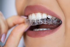 Fix Your Crossbite with Smilepath Australia’s Clear Aligners