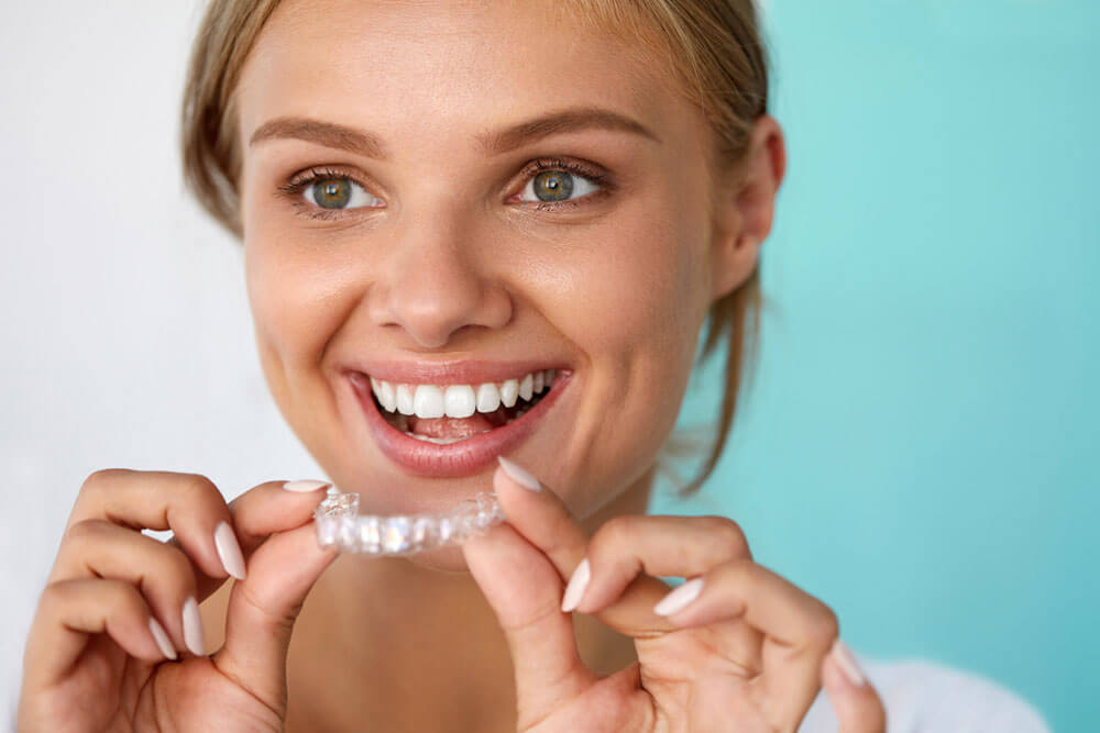 clear-aligners