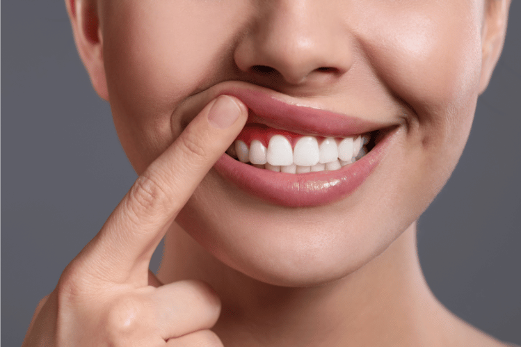 Teeth straightening and gum health